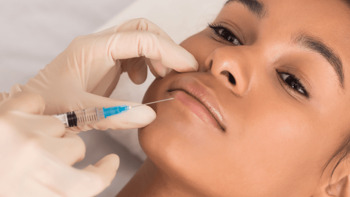 Plano preenchimento labial 2 ml